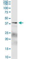 Anti-SPDEF Mouse Polyclonal Antibody