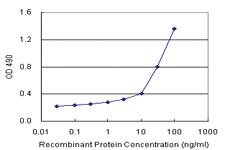 Anti-S100 A8 Antibody Pair