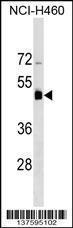 Anti-KRT36 Rabbit Polyclonal Antibody (PE (Phycoerythrin))