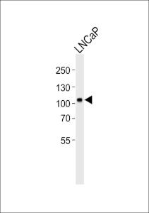 Anti-MME Rabbit Polyclonal Antibody