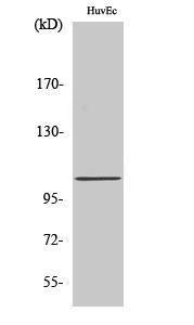 Anti-CBCP2 Rabbit Polyclonal Antibody