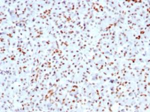 Immunohistochemical analysis of formalin-fixed, paraffin-embedded human pancreas using Anti-SOX9 Antibody [SOX9/3141R]