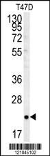 Anti-RHOQ Rabbit Polyclonal Antibody