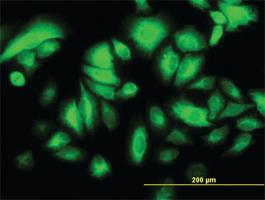 Anti-CK17 Mouse Monoclonal Antibody [clone: 2D4-1G9]