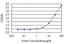 Anti-S100 A8 Antibody Pair