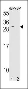 Anti-TIMP3 Rabbit Polyclonal Antibody (FITC (Fluorescein Isothiocyanate))