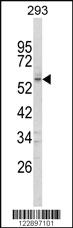 Anti-FOXC1 Rabbit Polyclonal Antibody