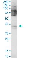 Anti-SPDEF Mouse Polyclonal Antibody