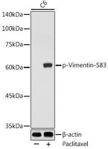 Western blot analysis of extracts of C6 cells, using Anti-Vimentin (phospho Ser83) Antibody (A308301) at 1:1,000 dilution C6 cells were treated by Paclitaxel (100 nM) at 37°C for 20 hours