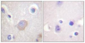 Immunohistochemical analysis of paraffin-embedded human brain using Anti-SHP-2 (phospho Tyr542) Antibody 1:100 (4 °C overnight). The right hand panel represents a negative control, where the Antibody was pre-incubated with the immunising peptide