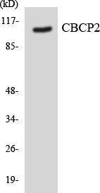 Western blot analysis of the lysates from Jurkat cells using Anti-CBCP2 Antibody