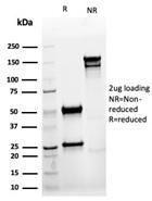 SDS-PAGE analysis of Anti-Cytokeratin 8 Antibody [rKRT8/6471] under non-reduced and reduced conditions; showing intact IgG and intact heavy and light chains, respectively. SDS-PAGE analysis confirms the integrity and purity of the antibody