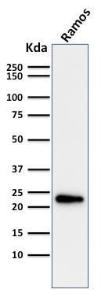 Western blot analysis of Ramos cell lysate using Anti-LMO2 Antibody [LMO2/1971]