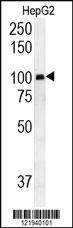 Anti-RASGRP1 Rabbit Polyclonal Antibody