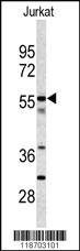 Anti-CPN2 Rabbit Polyclonal Antibody