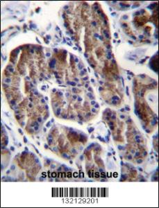 Anti-RPS4Y1 Rabbit Polyclonal Antibody