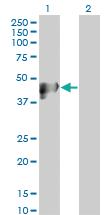 Anti-CK17 Mouse Monoclonal Antibody [clone: 2D10]