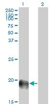 Anti-ESM1 Mouse Monoclonal Antibody [clone: 6D4]