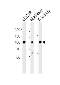 Anti-MME Rabbit Polyclonal Antibody