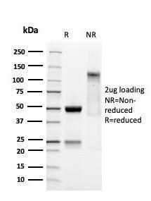 SDS-PAGE analysis of Anti-SOX9 Antibody [SOX9/3141R] under non-reduced and reduced conditions; showing intact IgG and intact heavy and light chains, respectively. SDS-PAGE analysis confirms the integrity and purity of the antibody.