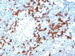 Immunohistochemical analysis of formalin-fixed, paraffin-embedded human tonsil using Anti-CD38 Antibody [rCD38/6447]