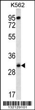 Anti-RPS4Y1 Rabbit Polyclonal Antibody