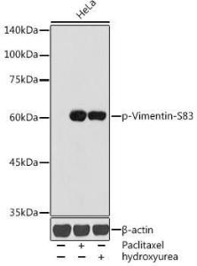 Western blot analysis of extracts of HeLa cells, using Anti-Vimentin (phospho Ser83) Antibody (A308301) at 1:1,000 dilution HeLa cells were treated by Paclitaxel (100 nM/ml) at 37°C for 20 hours HeLa cells were treated by Hydroxyurea (4 mM) at 37°C for 20 hours