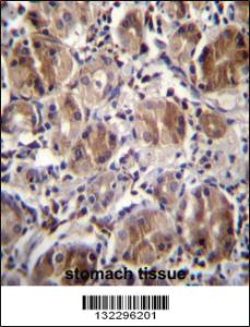 Anti-CTDNEP1 Rabbit Polyclonal Antibody