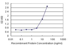 Anti-MIF Antibody Pair