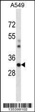 Anti-CSNK1A1 Rabbit Polyclonal Antibody (FITC (Fluorescein Isothiocyanate))