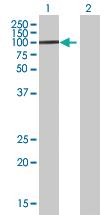 Anti-ZFP82 Mouse Polyclonal Antibody