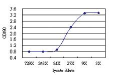 Anti-S100 A8 Antibody Pair