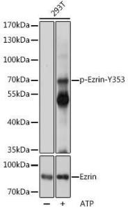 Western blot analysis of extracts of 293T cells, using Anti-Ezrin (phospho Tyr353) Antibody (A308302) at 1:1000 dilution or Ezrin Antibody (A0703). 293T cells were treated by ATP(5 mM) at 30°C for 1 hour