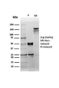 SDS-PAGE analysis of Anti-CD38 Antibody [rCD38/6447] under non-reduced and reduced conditions; showing intact IgG and intact heavy and light chains, respectively. SDS-PAGE analysis confirms the integrity and purity of the antibody