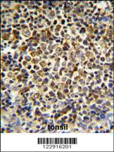 Anti-KIR2DL5B Rabbit Polyclonal Antibody