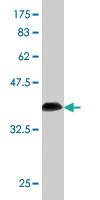 Anti-RP2 Mouse Monoclonal Antibody [clone: 1B4]