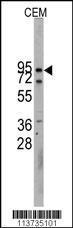 Anti-CDH10 Rabbit Polyclonal Antibody (HRP (Horseradish Peroxidase))