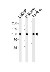 Anti-MME Rabbit Polyclonal Antibody