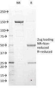 SDS-PAGE analysis of Anti-LMO2 Antibody [LMO2/1971] under non-reduced and reduced conditions; showing intact IgG and intact heavy and light chains, respectively. SDS-PAGE analysis confirms the integrity and purity of the antibody