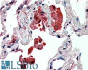 EB07898 (2.5 µg/ml) staining of paraffin embedded Human Lung. Steamed antigen retrieval with citrate buffer pH 6, AP-staining.