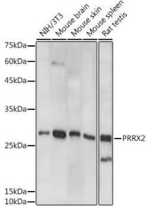 Anti-PRX-2 Rabbit Polyclonal Antibody