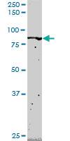 Anti-FLI1 Mouse Monoclonal Antibody [clone: 2G8]