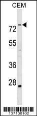 Anti-ABLIM3 Rabbit Polyclonal Antibody (FITC (Fluorescein Isothiocyanate))