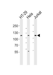 Anti-JAK1 Rabbit Polyclonal Antibody