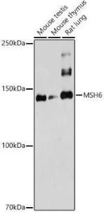 Western blot analysis of extracts of various cell lines, using Anti-MSH6 Antibody (A12741) at 1:1000 dilution. The secondary Antibody was Goat Anti-Rabbit IgG H&L Antibody (HRP) at 1:10000 dilution. Lysates/proteins were present at 25 µg per lane