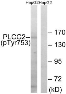 Antibody anti-PLCG2 phospho TYR753 100 µg