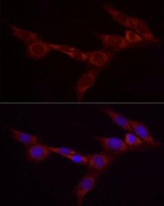 Immunofluorescence analysis of NIH/3T3 cells using Anti-Bcdin3d Antibody (A305739) at a dilution of 1:20 (40X lens). DAPI was used to stain the cell nuclei (blue)