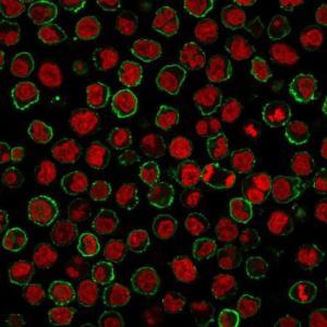 Anti-CD20 Mouse Monoclonal Antibody [clone: MS4A1/3409]