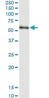 Anti-PFKFB2 Polyclonal Antibody Pair