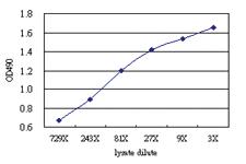 Anti-S100 A8 Antibody Pair